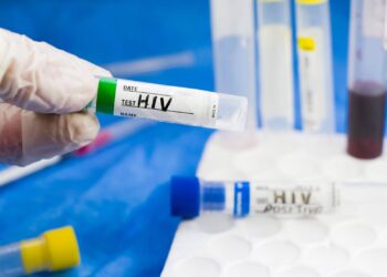 ترحيل 15 شابًا سودانيًا من مصر بعد تشخيص إصابتهم بفيروس نقص المناعة (HIV)