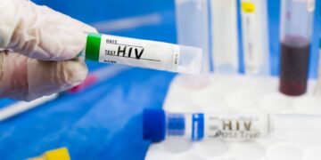 ترحيل 15 شابًا سودانيًا من مصر بعد تشخيص إصابتهم بفيروس نقص المناعة (HIV)